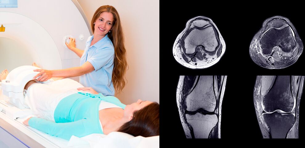 diagnóstico da articulación do xeonllo