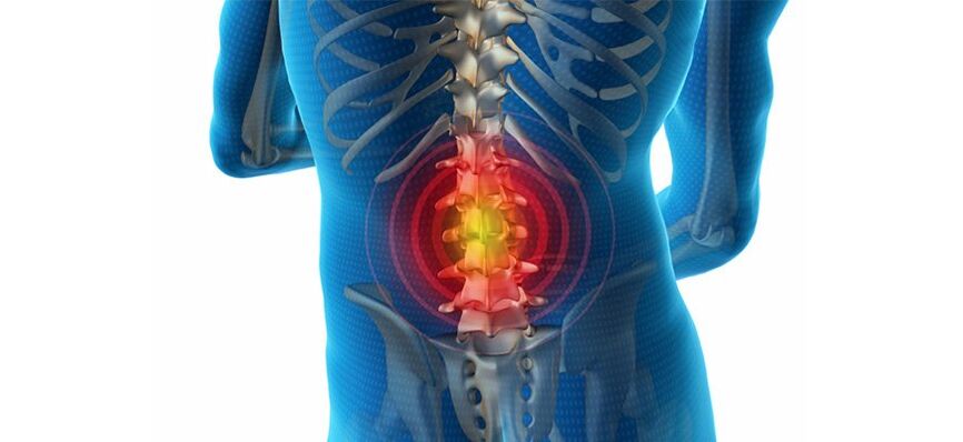 métodos para diagnosticar a dor nas costas